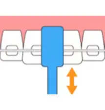 ブラッシング2(ワイヤーの下)図