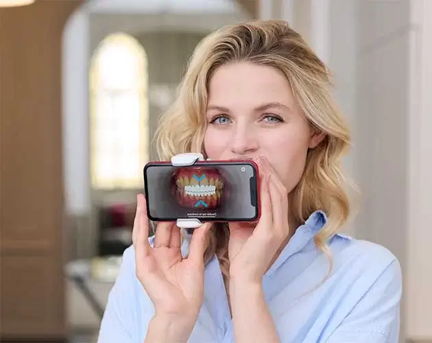 デンタルモニタリング image